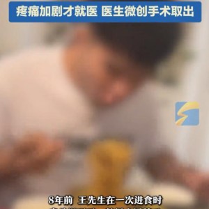 星空体育下载-46岁男子咽部“藏”12厘米金属筷子，时间长达8年，偶感不适，以为饮酒后正常反应